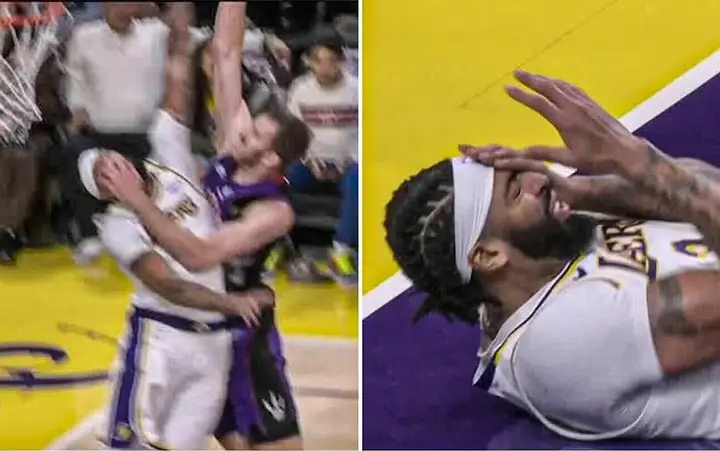 Lakers star Anthony Davis exits Raptors game with eye injury