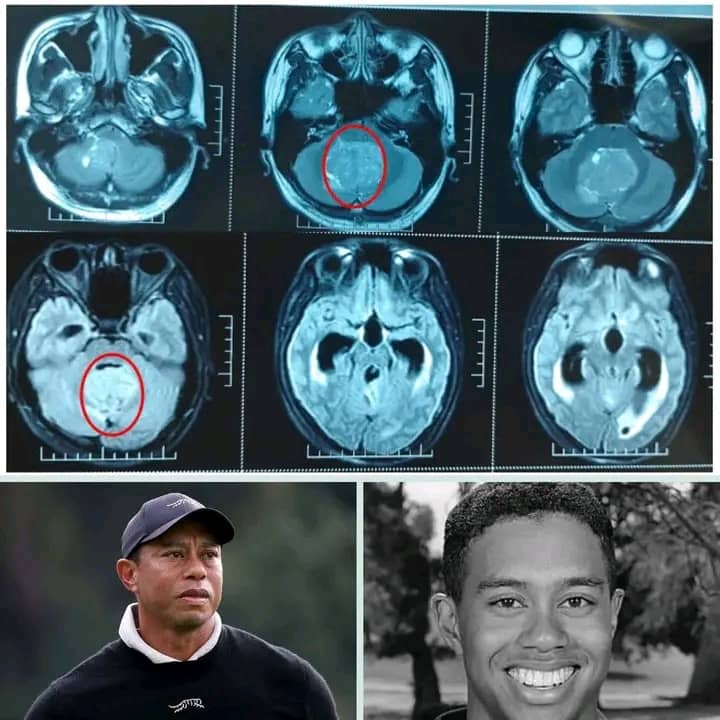 BREAKING: Just 30 Minutes Ago in California — URGENT Update on Golf Legend Tiger Woods at Age 49